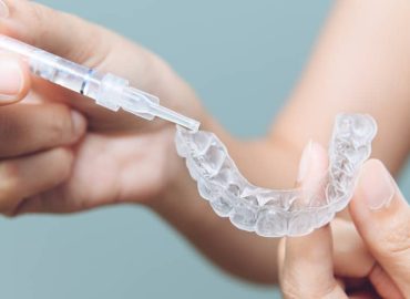 Clareamento-dental-com-moldeira-caseiro-botucatu-odontocentro