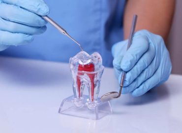 endodontia-dentistica (1)