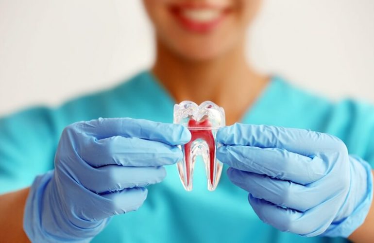 endodontia-tratamentos-de-canal (1)